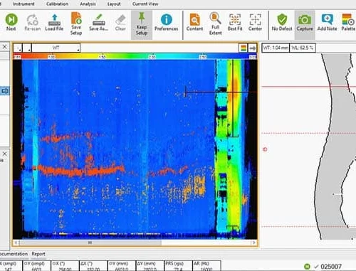 IRIS Ultrasound